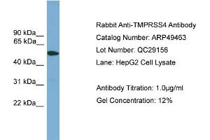 WB Suggested Anti-TMPRSS4  Antibody Titration: 0. (TMPRSS4 antibody  (Middle Region))