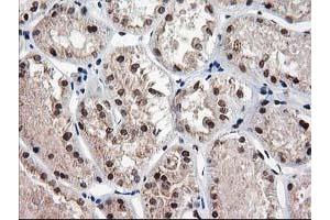 Immunohistochemical staining of paraffin-embedded Human Kidney tissue using anti-NUDT18 mouse monoclonal antibody. (NUDT18 antibody)
