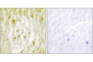 Immunohistochemistry (IHC) image for anti-General Transcription Factor IIE, Polypeptide 2 (GTF2E2) (AA 151-200) antibody (ABIN2889444)