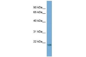 WB Suggested Anti-ATG12 Antibody Titration: 0. (ATG12 antibody  (Middle Region))