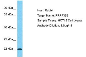 Host: Rabbit Target Name: PRPF38B Sample Type: HCT15 Whole Cell lysates Antibody Dilution: 1.