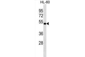 Western Blotting (WB) image for anti-N-Acylethanolamine Acid Amidase (NAAA) antibody (ABIN3000319)