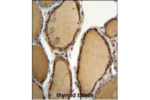 KLRAQ1 Antibody (Center) (ABIN655120 and ABIN2844751) immunohistochemistry analysis in formalin fixed and paraffin embedded human thyroid tissue followed by peroxidase conjugation of the secondary antibody and DAB staining. (KLRAQ1 antibody  (AA 207-236))