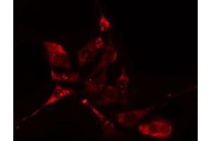 ABIN6276612 staining HuvEc cells by IF/ICC. (CA3 antibody  (N-Term))