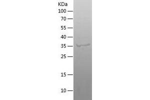 Western Blotting (WB) image for Chromosome 18 Open Reading Frame 8 (C18orf8) (AA 1-305) protein (His tag) (ABIN7122383) (C18orf8 Protein (AA 1-305) (His tag))