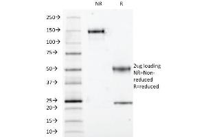 SDS-PAGE Analysis Purified S100A1 Mouse Monoclonal Antibody (S100A1/1942).