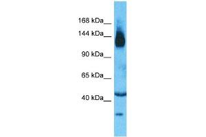 Host:  Rabbit  Target Name:  SLC12A2  Sample Type:  Thymus Tumor lysates  Antibody Dilution:  1. (SLC12A2 antibody  (N-Term))