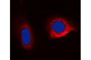 Immunofluorescent analysis of Caspase 6 staining in HepG2 cells.