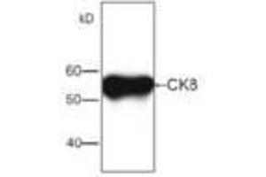 Image no. 1 for anti-Keratin 8 (KRT8) antibody (ABIN791532) (KRT8 antibody)