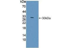 Detection of Recombinant GAMT, Rat using Polyclonal Antibody to Guanidinoacetate-N-Methyltransferase (GAMT) (GAMT antibody  (AA 2-236))