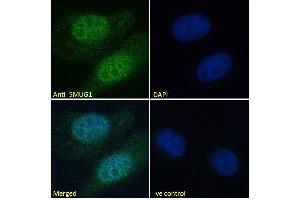 ABIN185204 Immunofluorescence analysis of paraformaldehyde fixed U2OS cells, permeabilized with 0. (SMUG1 antibody  (N-Term))