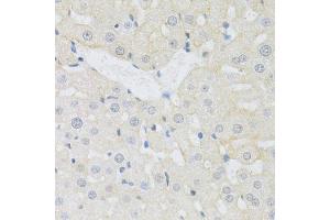 Immunohistochemistry of paraffin-embedded rat liver using SLC3A2 antibody (ABIN1876903) at dilution of 1:100 (40x lens). (SLC3A2 antibody)