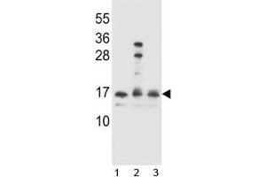 HOPX antibody western blot analysis in 1) Ramos, 2) A2058 and 3) 293 lysate. (HOPX antibody  (AA 39-67))