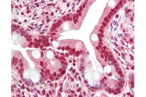 Anti-GHDC antibody IHC staining of human small intestine. (GHDC antibody  (N-Term))