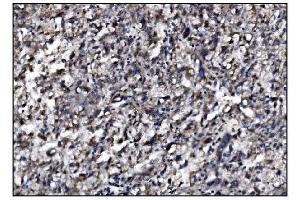 IHC analysis of SLFN11 using anti-SLFN11 antibody (ABIN7599761). (SLFN11 antibody  (AA 114-794))