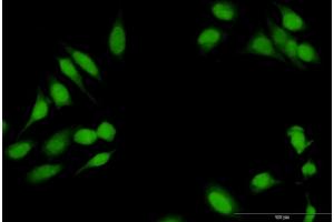 Immunofluorescence of purified MaxPab antibody to RBL1 on HeLa cell. (p107 antibody  (AA 1-1014))
