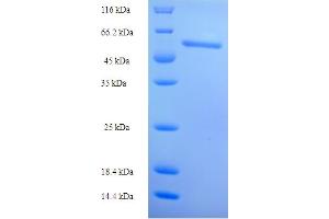 SDS-PAGE (SDS) image for Thioredoxin Reductase 1 (TXNRD1) (AA 1-497), (partial) protein (His-SUMO Tag) (ABIN5711259)