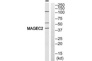 Western blot analysis of extracts from 293 cells, using MAGEC2 antibody. (MAGEC2 antibody  (Internal Region))