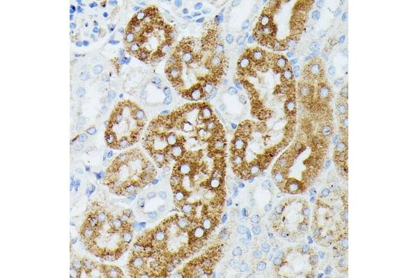 MAP3K1 antibody  (C-Term)