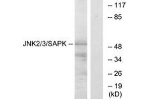 Western blot analysis of extracts from HepG2 cells, using SAPK/JNK (Ab-185) Antibody. (SAPK, JNK (AA 151-200) antibody)