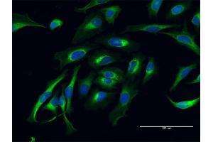 Immunofluorescence of purified MaxPab antibody to LAMB1 on HeLa cell. (Laminin beta 1 antibody  (AA 1-1786))