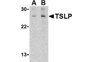 Western Blotting (WB) image for anti-Thymic Stromal Lymphopoietin (TSLP) (C-Term) antibody (ABIN1030782) (Thymic Stromal Lymphopoietin antibody  (C-Term))