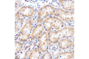 Immunohistochemistry of paraffin-embedded Rat kidney using p38 MAPK Rabbit pAb (ABIN7268616) at dilution of 1:100 (40x lens). (MAPK14 antibody  (C-Term))