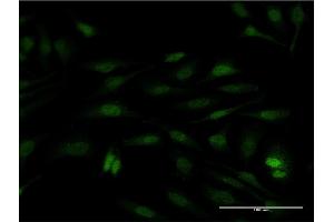 Immunofluorescence of monoclonal antibody to SUB1 on HeLa cell. (SUB1 antibody  (AA 32-124))
