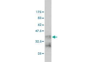 Western Blot detection against Immunogen (36. (GTPase NRas antibody  (AA 90-189))