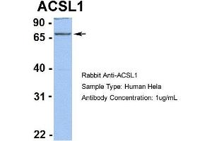 Human Hela (ACSL1 antibody  (C-Term))