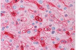 Human Liver (formalin-fixed, paraffin-embedded) stained with B2M antibody ABIN334257 at 5 ug/ml followed by biotinylated anti-mouse IgG secondary antibody ABIN481714, alkaline phosphatase-streptavidin and chromogen. (beta-2 Microglobulin antibody)