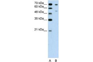 WB Suggested Anti-FOXB2 Antibody Titration:  0. (FOXB2 antibody  (N-Term))