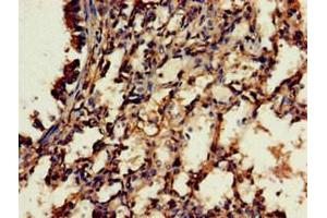 Immunohistochemistry of paraffin-embedded human lung tissue using ABIN7166771 at dilution of 1:100 (RBFA antibody  (AA 201-343))