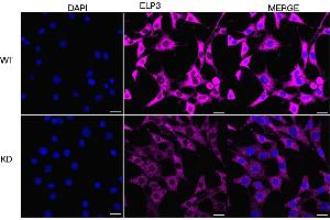 Immunocytochemical staining of HT- cells using ELP3 antibody (ABIN7798434), 1:1,000), Top panel: wild-type (WT), Bottom panal: ELP3 shRNA knockdown (KD). (Recombinant ELP3/KAT9 antibody)