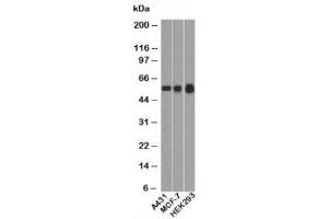 Western blot testing of human samples with p53 antibody (BP53-12). (p53 antibody  (N-Term))