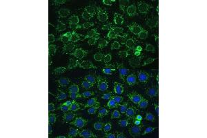 Immunofluorescence analysis of C6 cells using C1 Polyclonal Antibody (ABIN7265723) at dilution of 1:100 (40x lens). (ATP5C1 antibody  (AA 26-298))