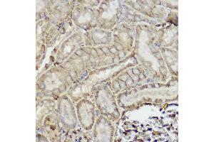 Immunohistochemistry of paraffin-embedded mouse kidney using P Glycoprotein Rabbit pAb (ABIN6134229, ABIN6136340, ABIN6136343 and ABIN6215453) at dilution of 1:250 (40x lens).