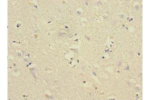 Immunohistochemistry of paraffin-embedded human brain tissue using ABIN7148474 at dilution of 1:100
