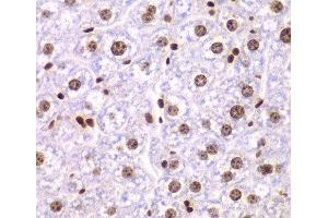 Immunohistochemistry of paraffin-embedded Mouse liver using SSRP1 Polyclonal Antibody at dilution of 1:200 (40x lens).
