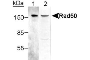 Image no. 2 for anti-RAD50 Homolog (S. Cerevisiae) (RAD50) antibody (ABIN363487) (RAD50 antibody)