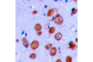 Immunohistochemical analysis of CFTR staining in human brain formalin fixed paraffin embedded tissue section. (CFTR antibody  (Center))