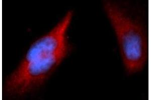 Immunofluorescence (IF) image for anti-Peptidylprolyl Cis/trans Isomerase, NIMA-Interacting 1 (PIN1) antibody (PE) (ABIN5565413) (PIN1 antibody  (PE))