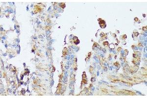Immunohistochemistry of paraffin-embedded Mouse lung using WNT1 Polyclonal Antibody at dilution of 1:100 (40x lens). (WNT1 antibody)