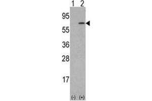 Western blot analysis of M-CSF (arrow) using rabbit polyclonal M-CSF Antibody (Center) . (M-CSF/CSF1 antibody  (Middle Region))
