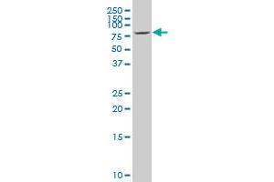 CHML polyclonal antibody (A01), Lot # 061101JCS1 Western Blot analysis of CHML expression in HepG2 . (CHML antibody  (AA 68-177))