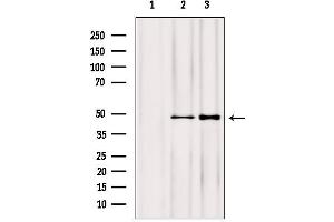 Western blot analysis of extracts from various samples, using NOB1 antibody.