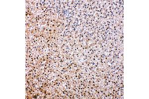 Anti-VCP antibody, IHC(P) IHC(P): Rat Epinephros Tissue (VCP antibody  (C-Term))