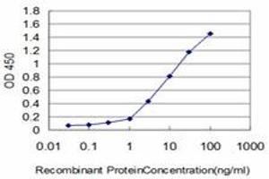 Detection limit for recombinant GST tagged KIAA2002 is approximately 0. (PEAK1 antibody  (AA 1151-1250))
