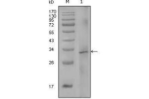 Western Blot showing F8 antibody used against truncated Trx-F8 recombinant protein (1). (Factor VIII antibody)