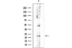 anti-Progesterone Receptor Membrane Component 2 (PGRMC2) (C-Term) antibody